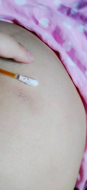 借卵做试管婴儿人工授精后应该怎样注意事项