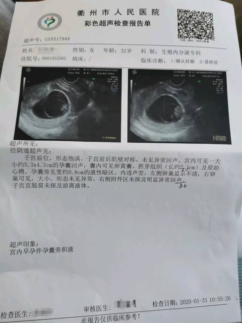 广州省做借卵试管婴儿需多少钱